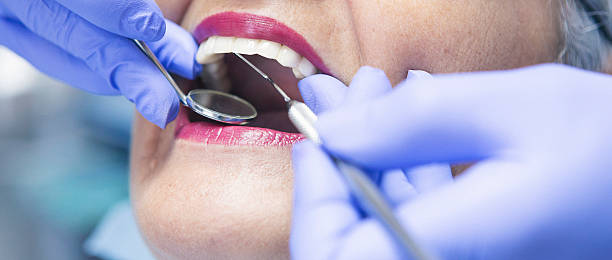 Best Emergency Dentist for Lost Fillings or Crowns in Vale, OR